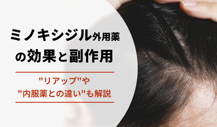 ミノキシジル外用薬の効果と副作用　リアップや内服薬との違いも解説